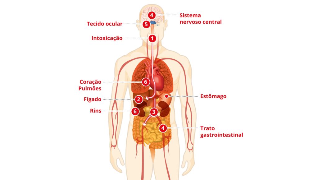 Intoxicação por Metanol: Riscos e Danos à Saúde Intoxicação por Metanol: Riscos e Danos à Saúde