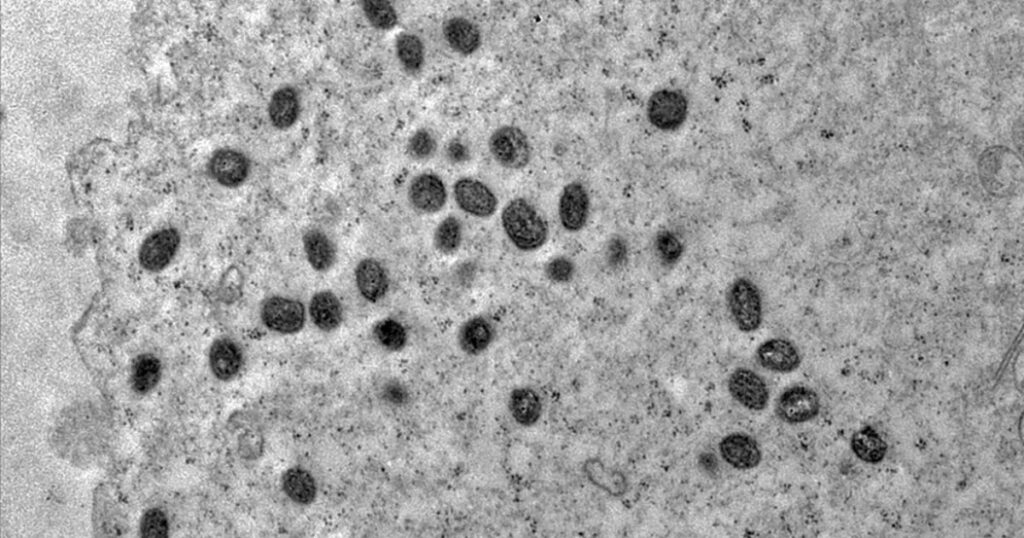 Mpox: Brasil Registra 140 Casos, Mas Ministério da Saúde Não Vê Motivo para Alerta Mpox: Brasil Registra 140 Casos, Mas Ministério da Saúde Não Vê Motivo para Alerta